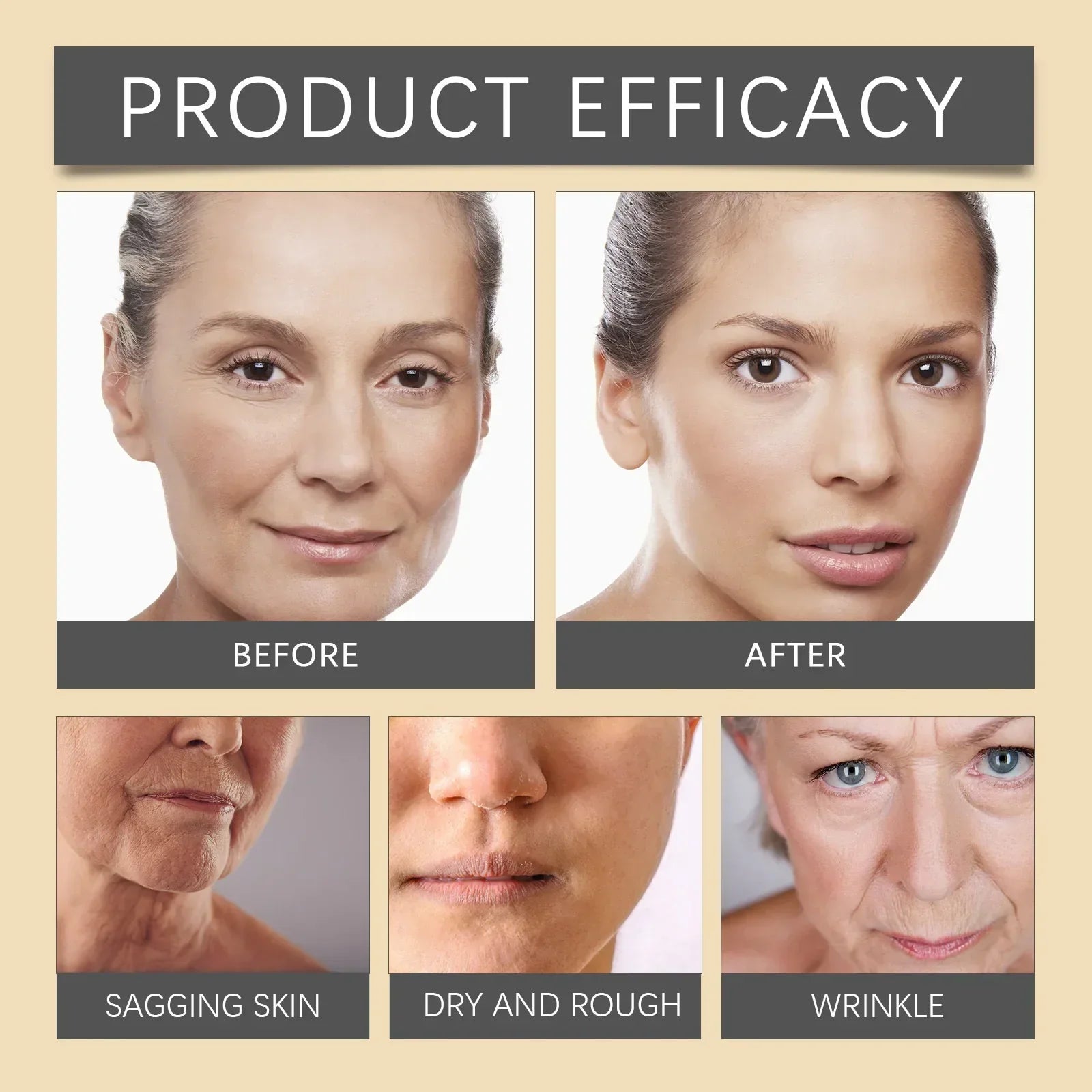 🐝💎 Botox Bee Venom Wrinkle Removal Cream 💎🐝-Shop