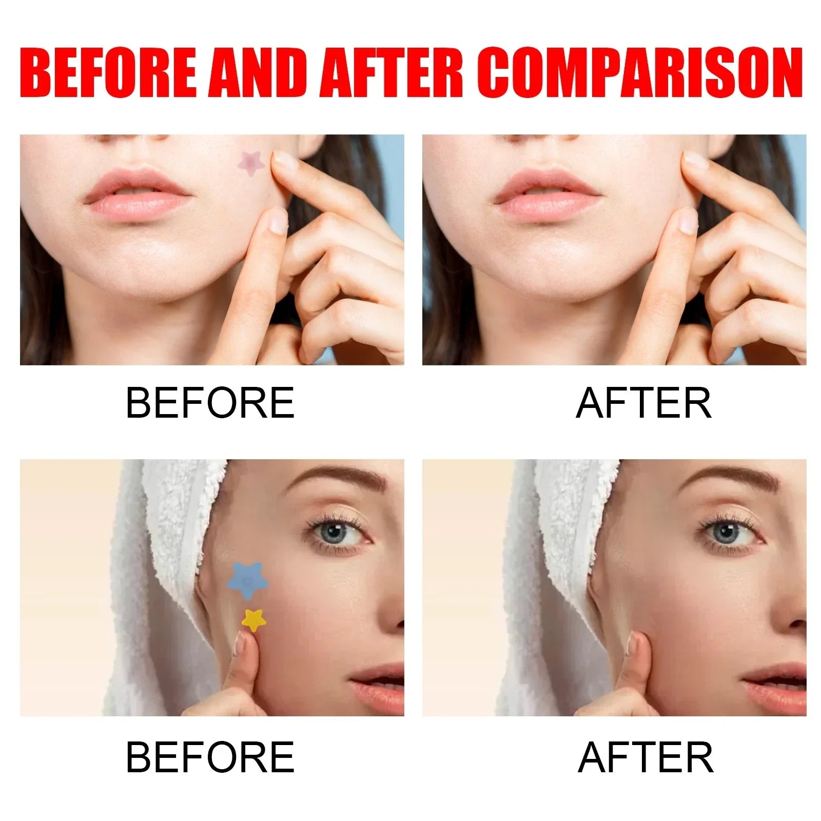 Pimple Patches,Pimple Patches For Face, Hydrocolloid Acne Patches, Cute Star Sti-Shop
